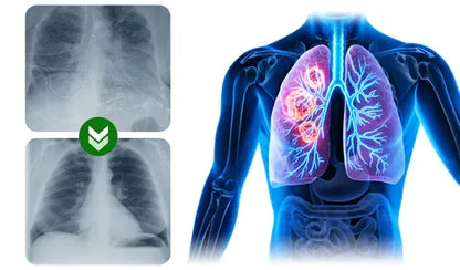 BREATHE-RIGHT ORGANIC HERBAL ORAL LUNG SPRAY: POWERFUL LUNG SUPPORT CLEANSE & REPAIR.