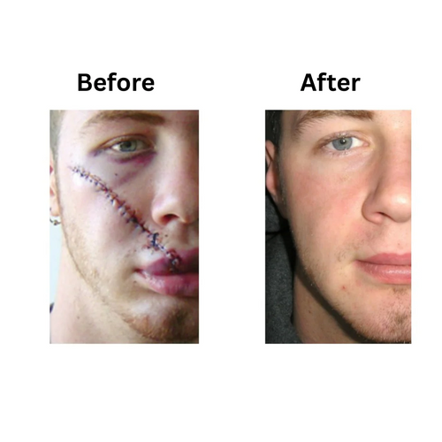 SCAR SPRAY Z360
