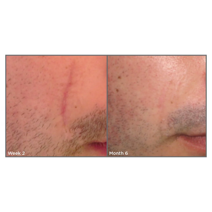 SCAR SPRAY Z360