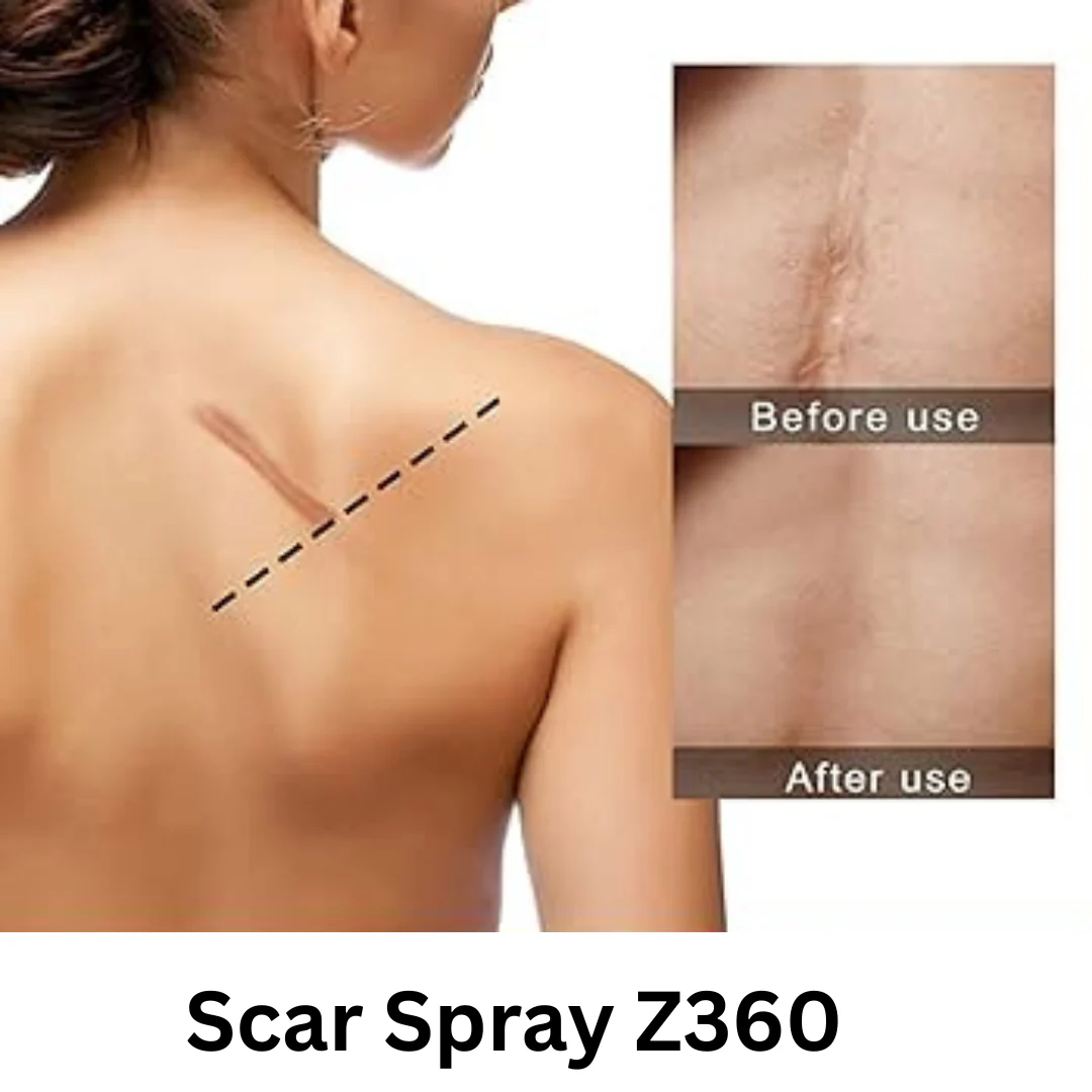 SCAR SPRAY Z360