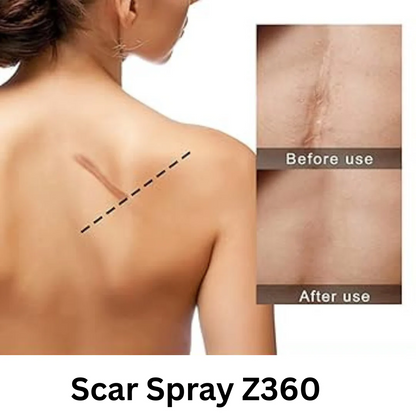 SCAR SPRAY Z360