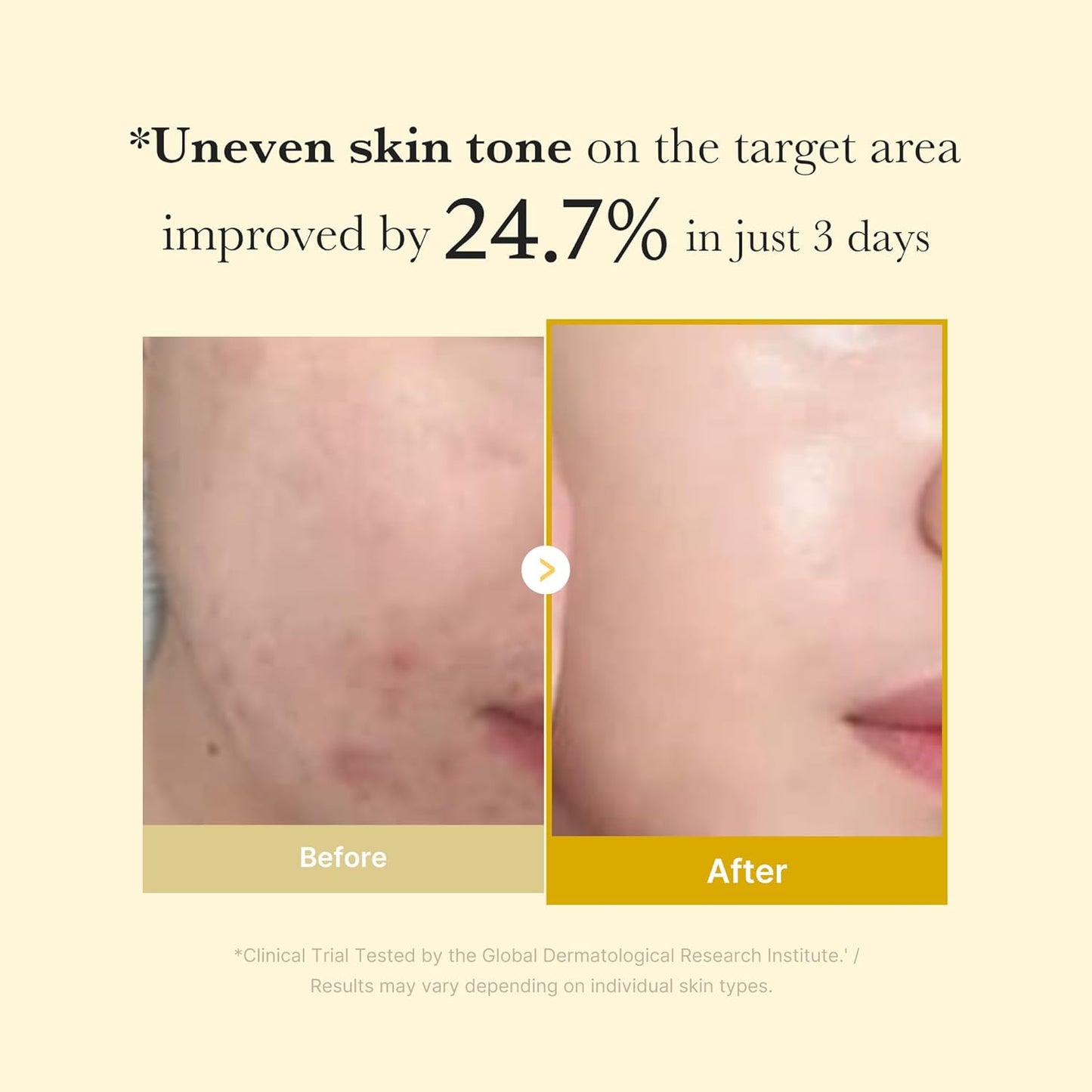Medicube Kojic Acid Turmeric Night Wrapping Mask 75ml Expiry 06 - 2028